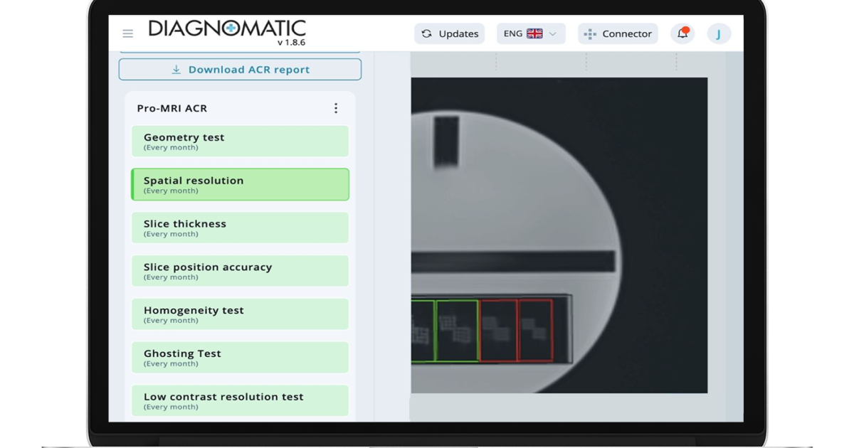Diagnostic CT Performance: From Data to Confidence | Standard Imaging