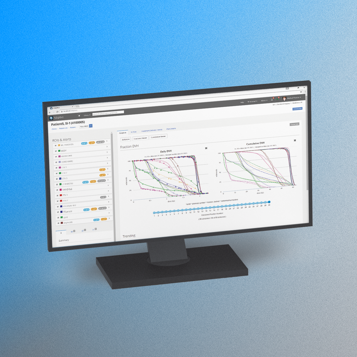 Adaptivo feature dvh 1400
