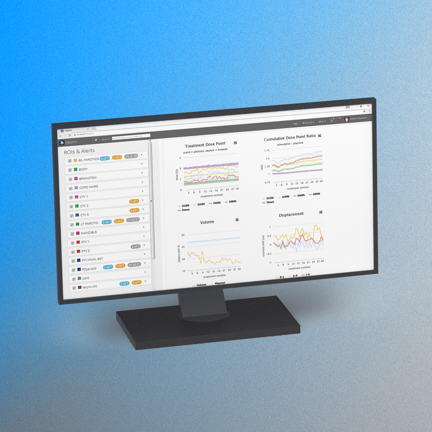 Adaptivo feature leverage data 2 1400