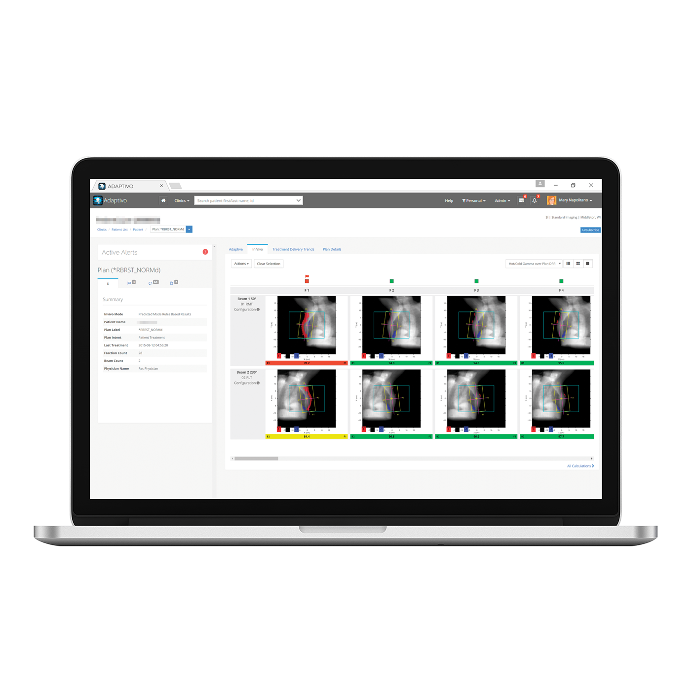 Adaptivo main NEW 1400