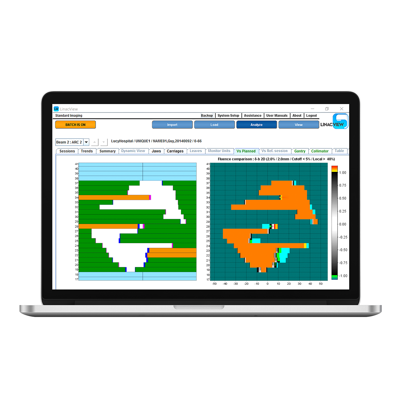 Linacview feature 1400 v2